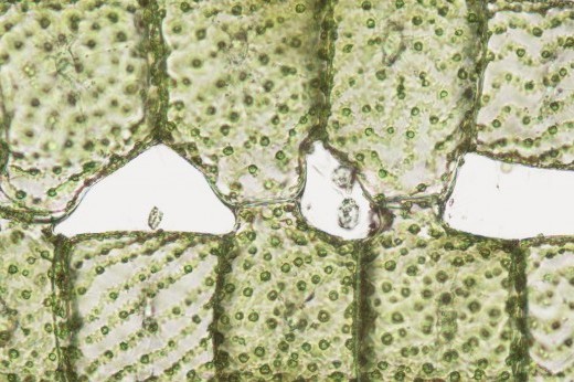 Spirogyra algae cells